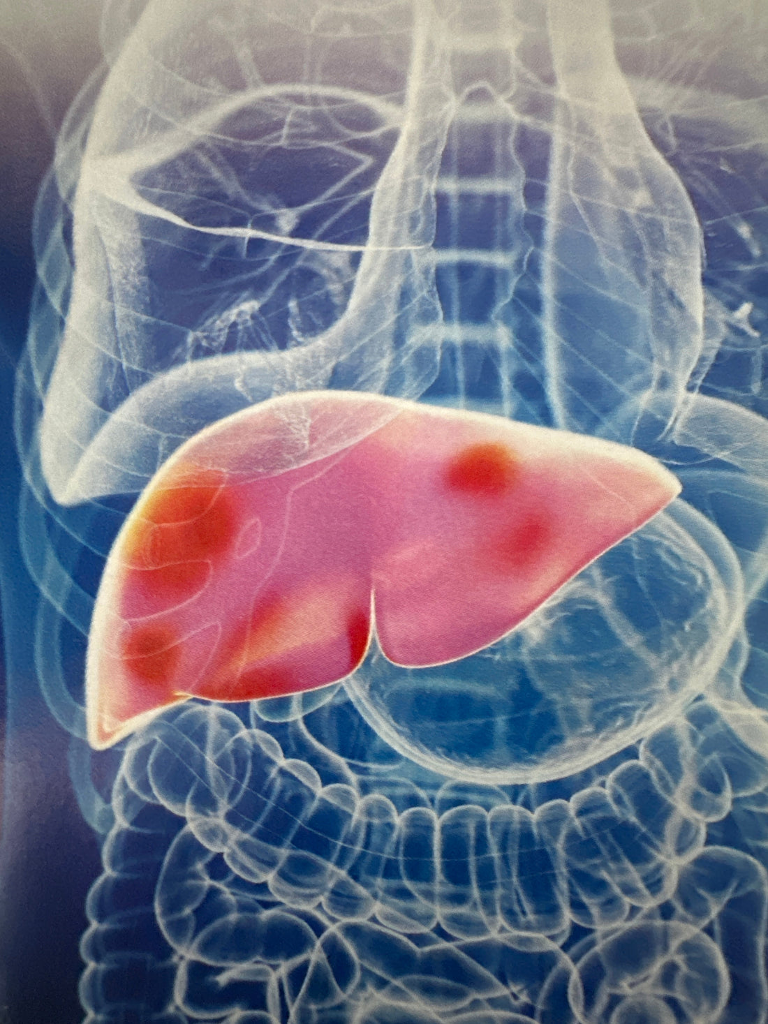 Is Your Liver Healthy? How Vitamin E Can Help!
